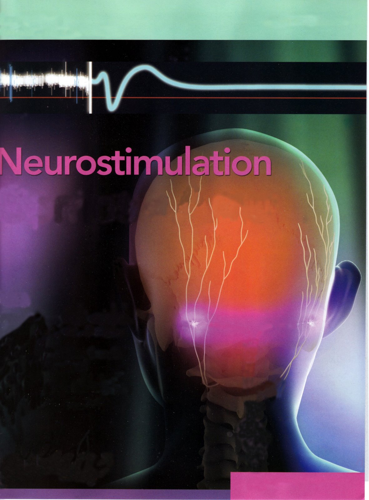 [AIM+Stimualtion+Brain+5-18-2007.jpg]