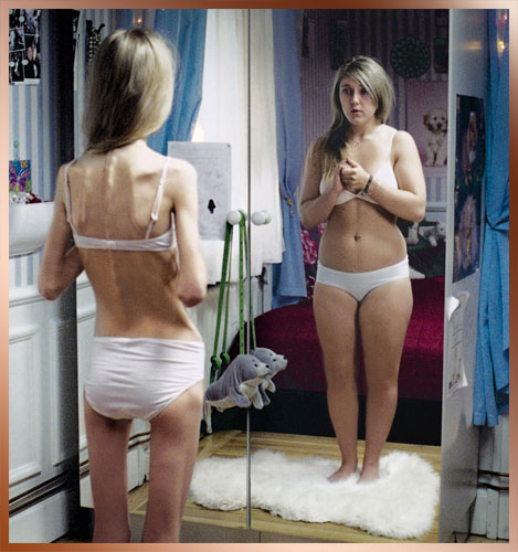 [anorexia.jpg]