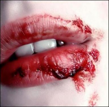 [Bloody_Kisses_by_SafetypinHeart.jpg]
