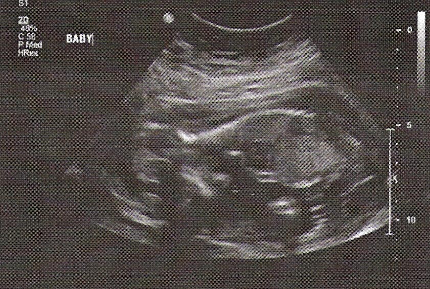 [ultrasound1.jpg]
