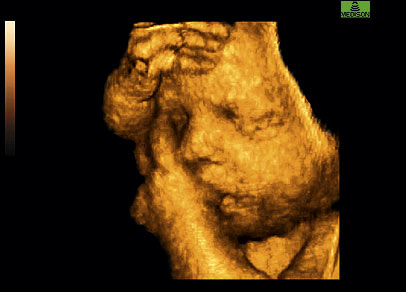 [baby+in+womb.jpg]