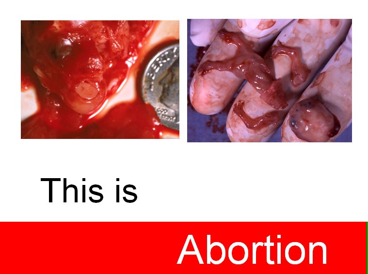 [This+is+Abortion.bmp]