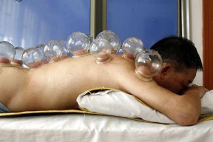 [chinese-acupuncture-cupping.jpg]