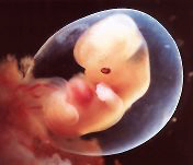 [embrion_07.jpg]