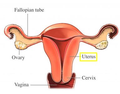 [uterus.jpg]