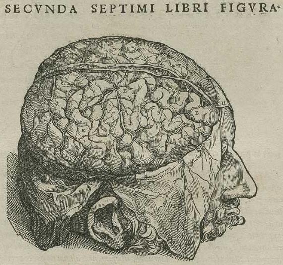 [Brain+surgery.JPG]