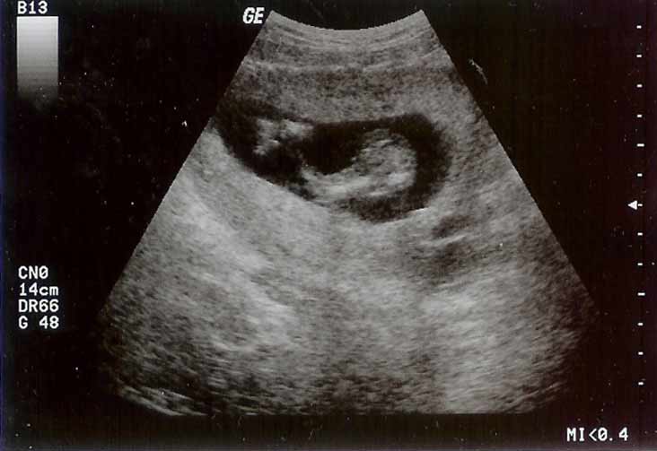 [new-baby-ultrasound-1-770076.jpg]