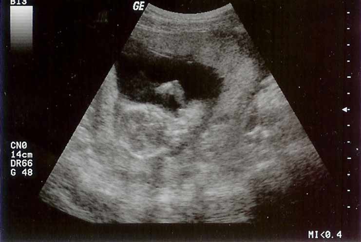 [new-baby-ultrasound-2-770684.jpg]