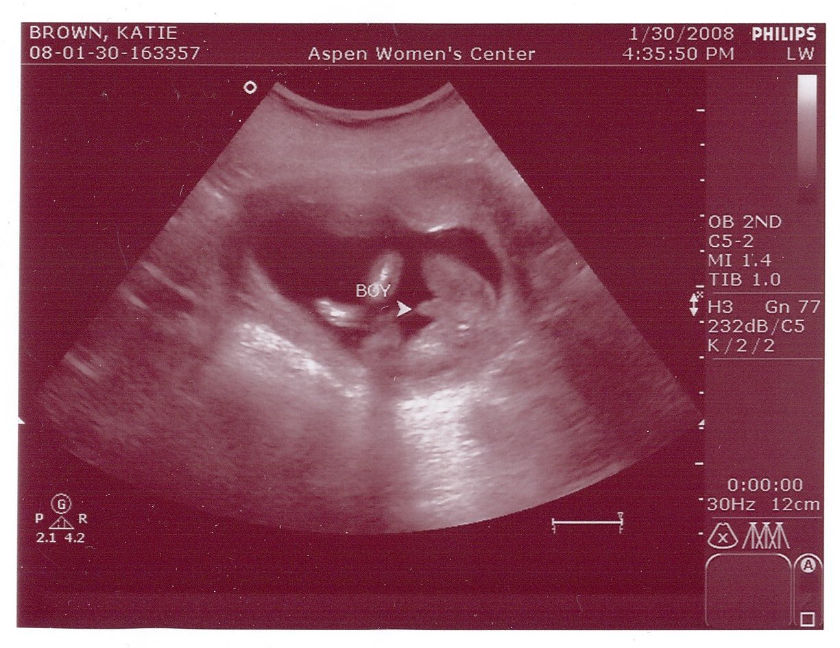 [Baby+Ultrasound+3.jpg]