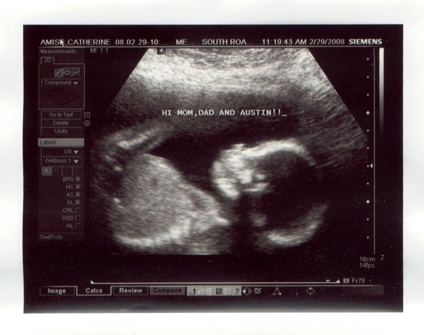 [ultrasound+2.jpg]