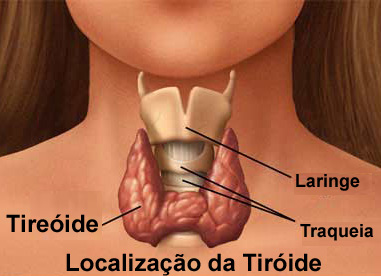 [Tiroide4.jpg]