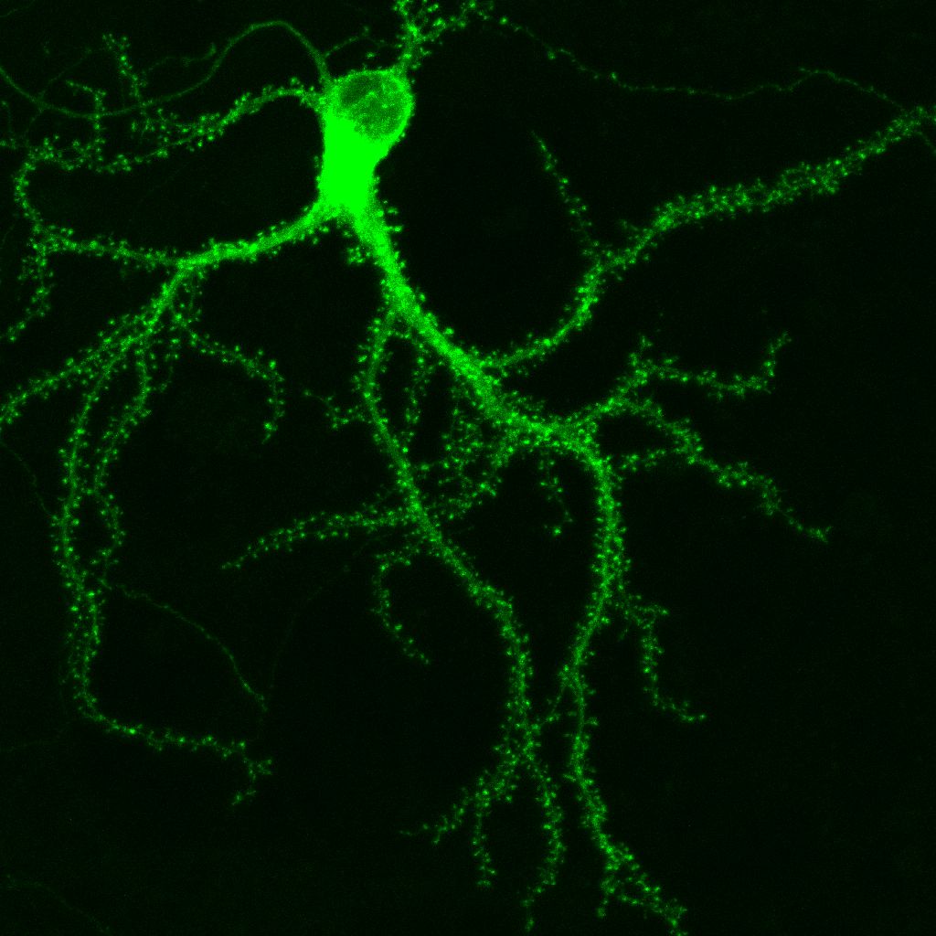 [fluorescent_neuron.jpg]