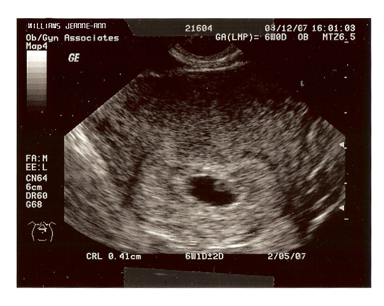 [baby+fetus.jpg]