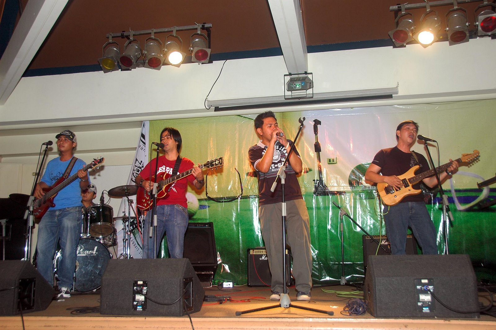 MIGS BAND