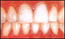 [healthy-teeth[1].jpg]