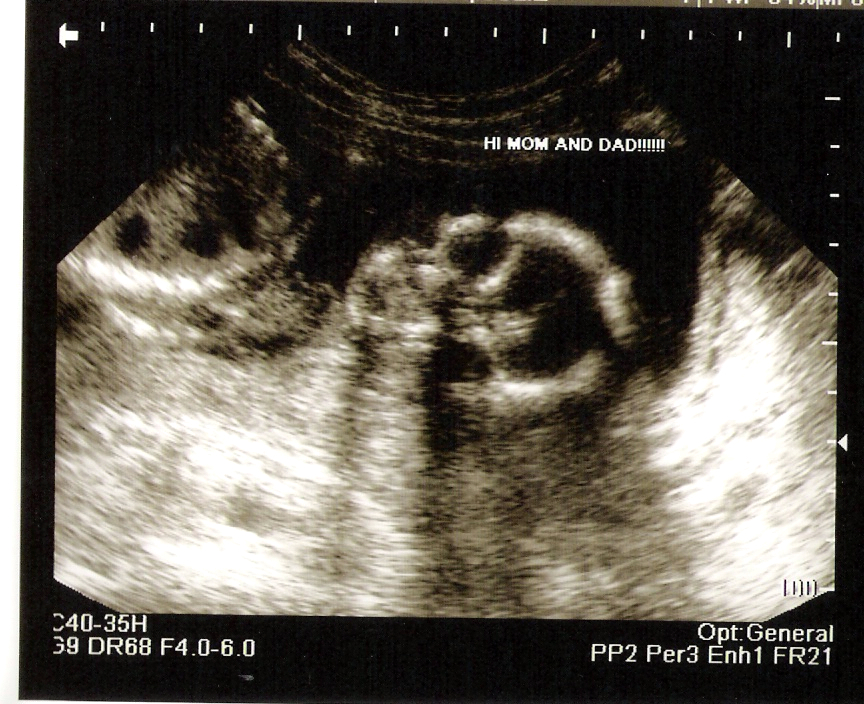 [Baby+boy+ultrasound+004.jpg]