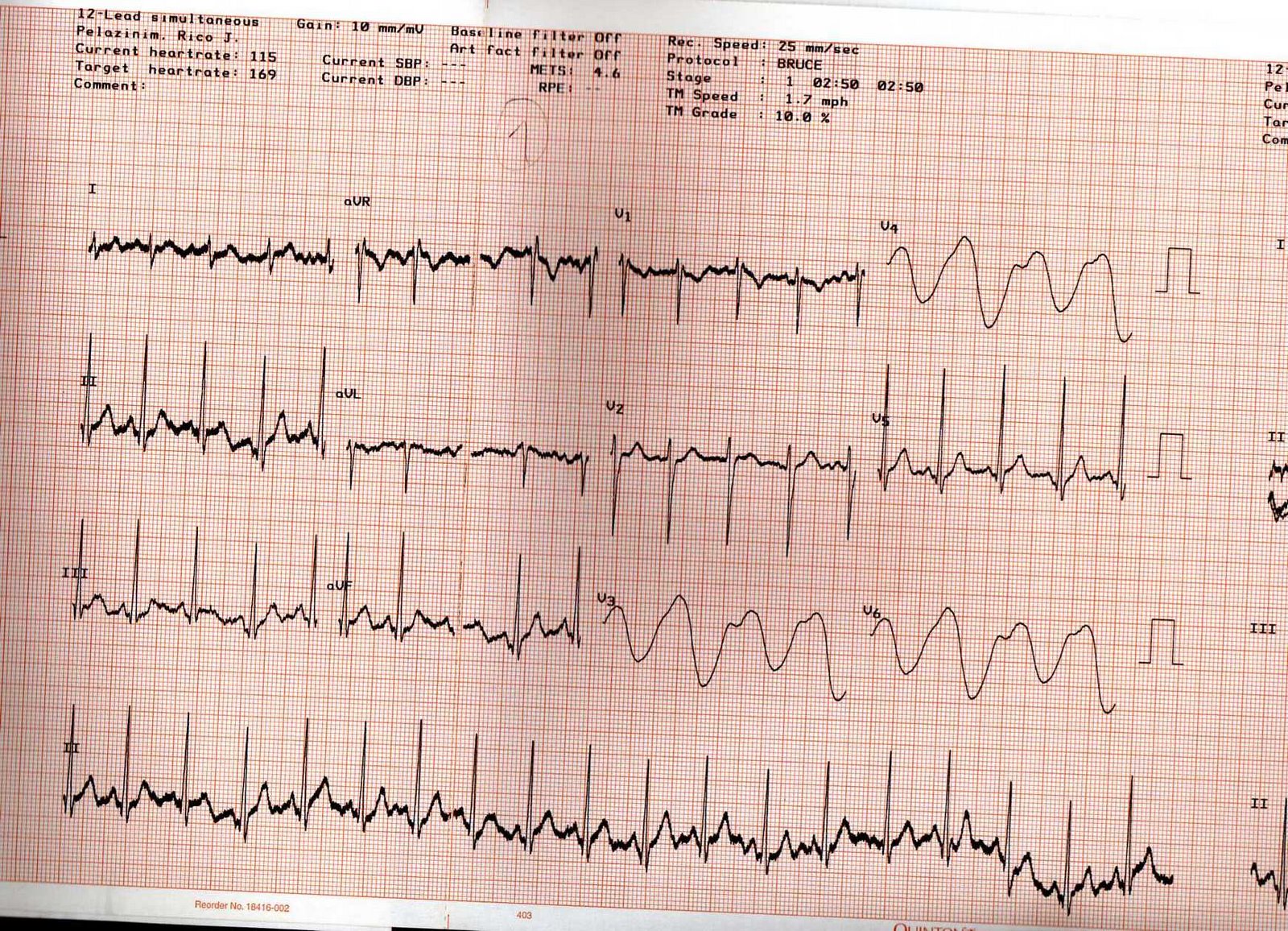 [EKG+3.jpg]