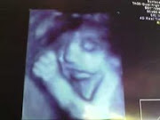 Elijah's 4D ultrasound @ 27 weeks
