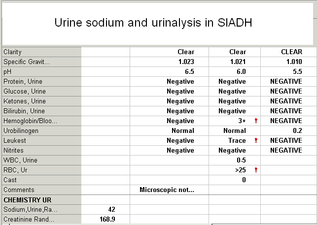 [Urine+sodium+and+UA+in+SIADH+1-3.png]