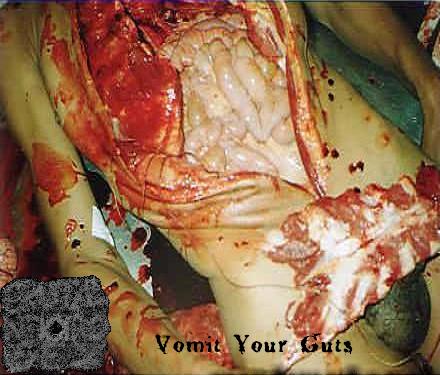 [Brutal+Nekkro+Sex+-+Vomit+Your+Guts+-+cover+-+front.JPG]