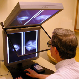 [mamografia1.jpg]