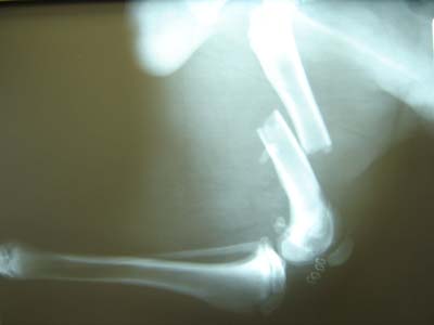 [MRVH fractured femur 090.jpg]