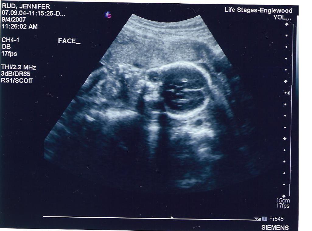 [ultrasound(1)+9.4.07.JPG]