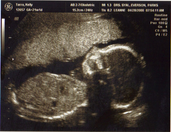 [ultrasound-profile.jpg]