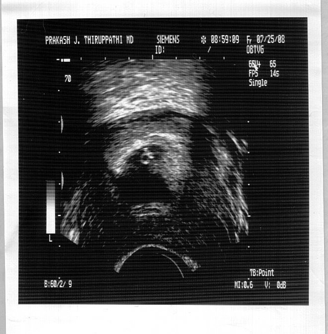 [6_wk_ultrasound.jpg]