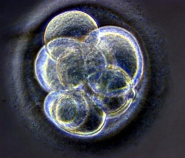 [embryon.jpg]