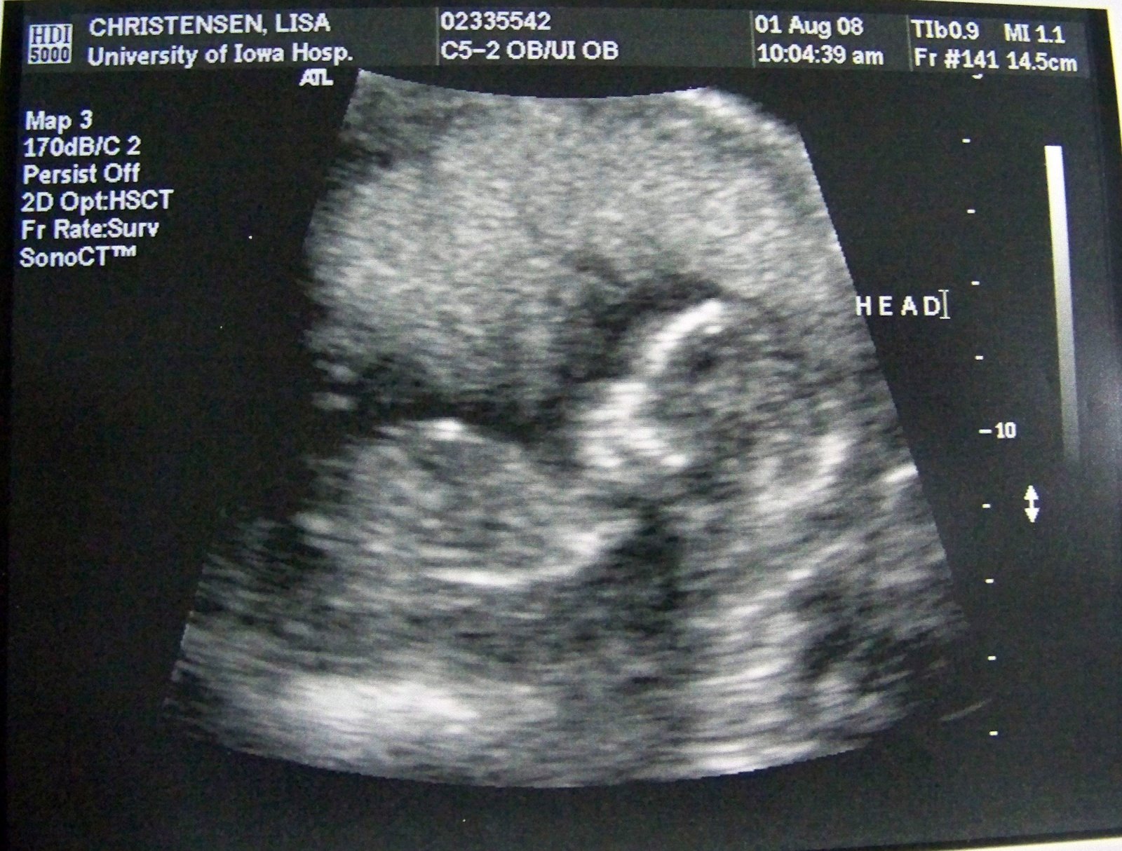[8-1-08-ultrasound-web-3.jpg]