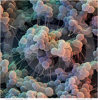 [199812-026-Staph-Bacteria.jpg]