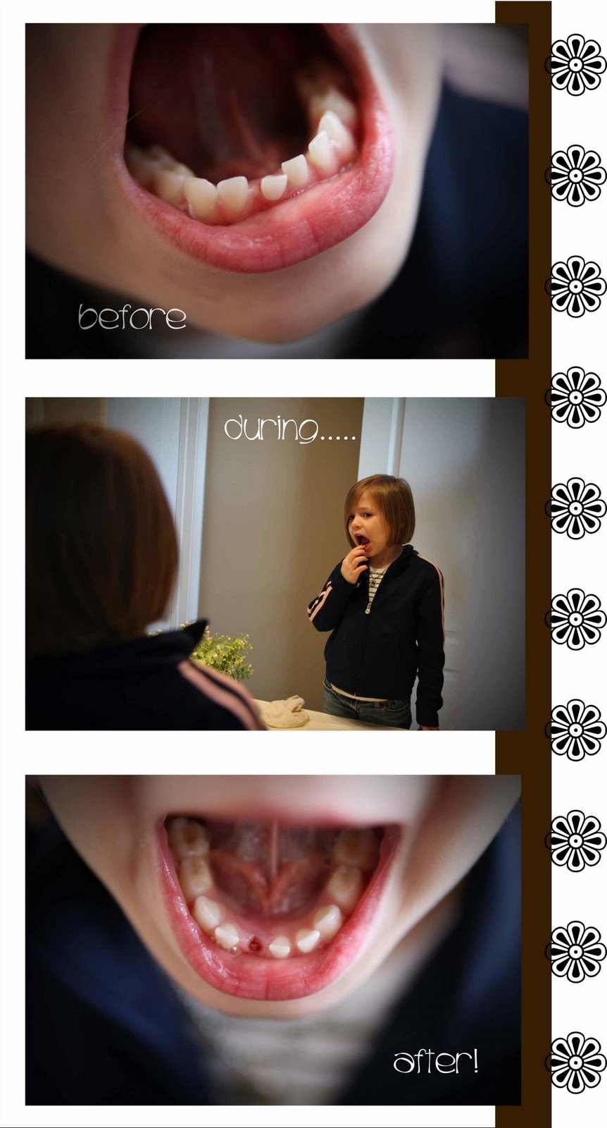 [tooth.jpg]