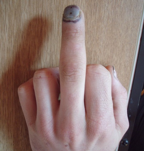 [finger.jpg]