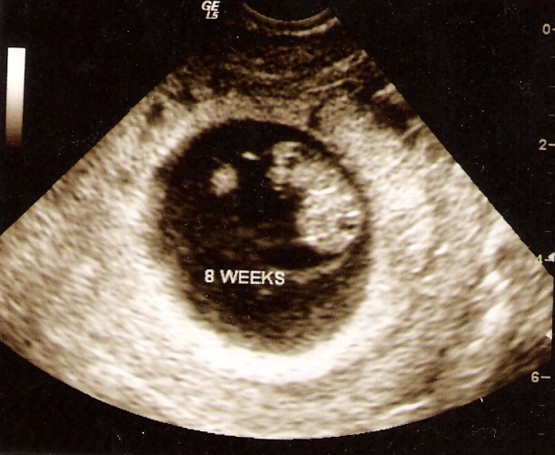 [1st+ultrasound.jpg]