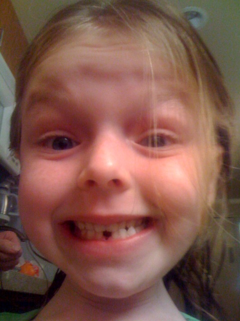 Ella Lost Her First Tooth