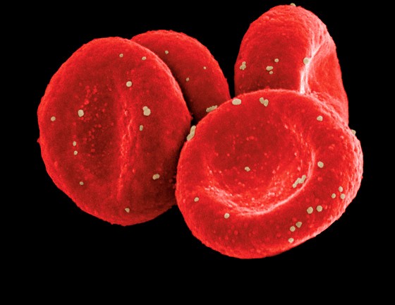 [red+bloods+cells.jpg]