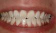 [tooth+whitening+2.bmp]