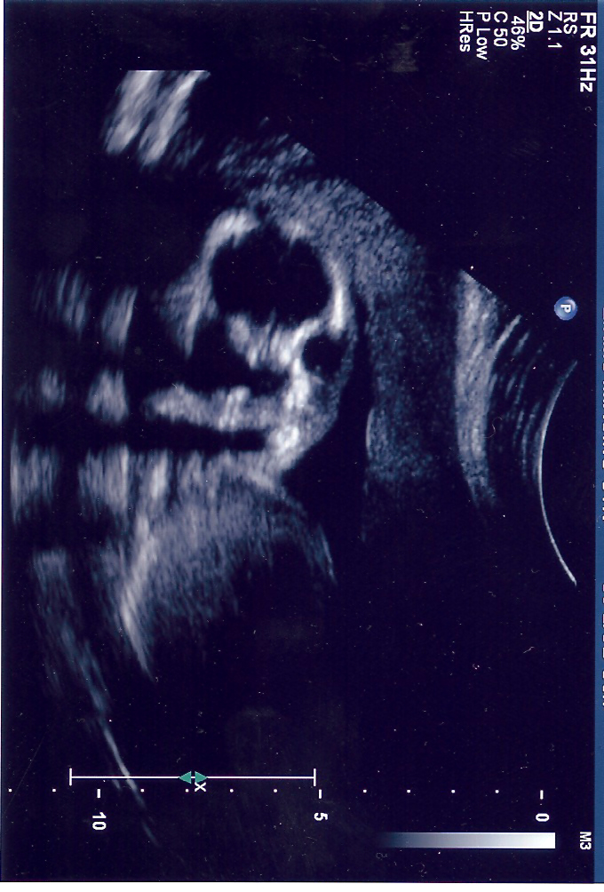 [Skeletor+-+Ultrasound.jpg]