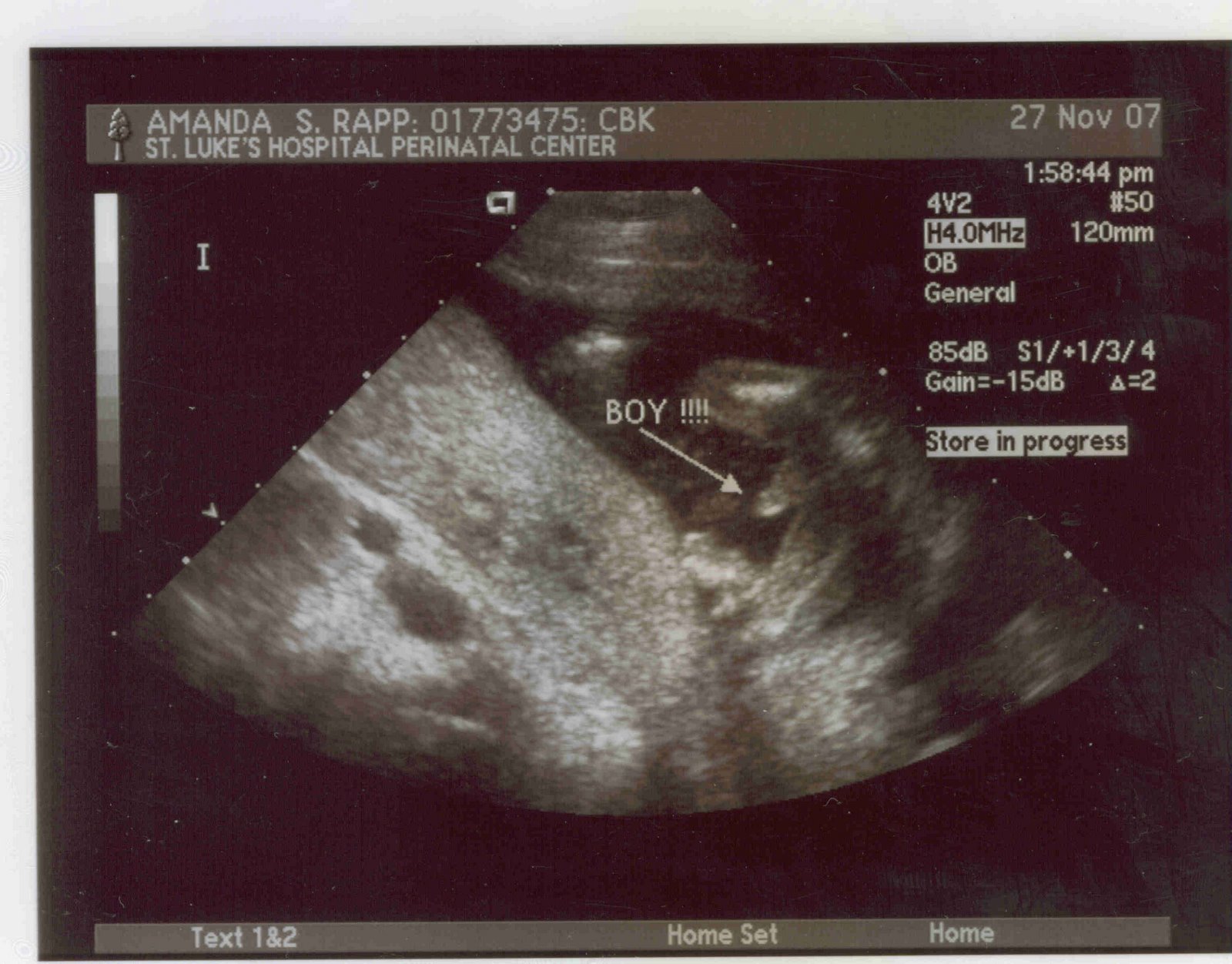 [ultrasound+3.jpg]