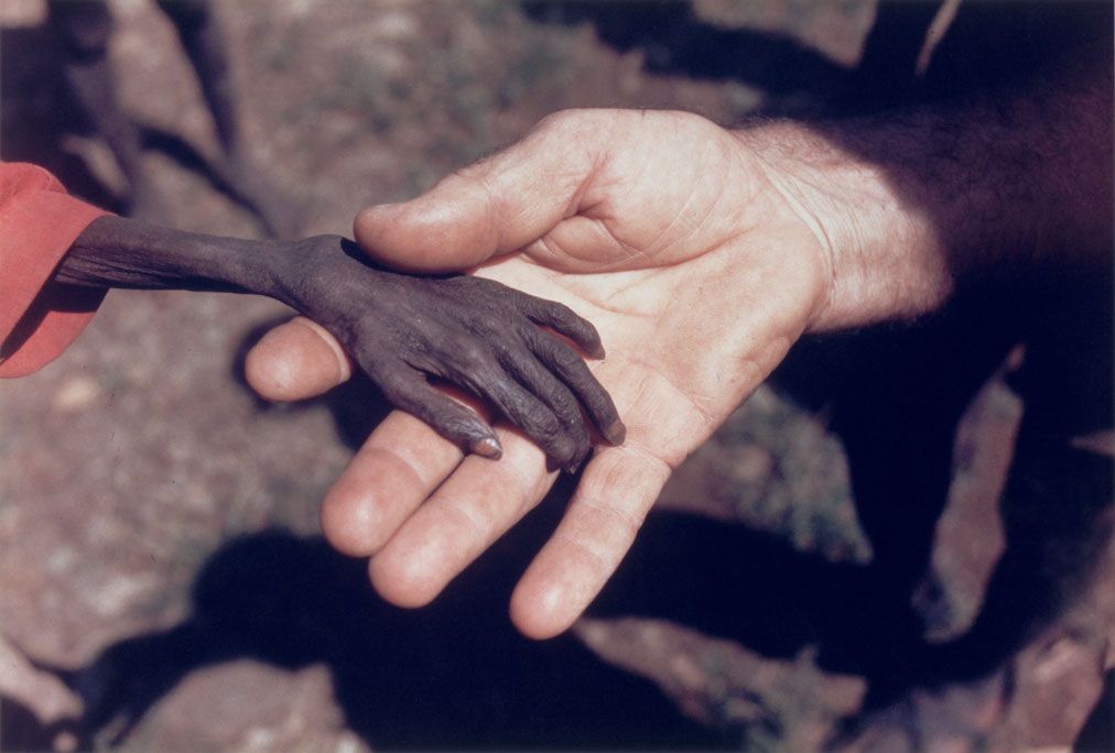 [District+de+Karamoja,+Uganda,+avril+1980+(Mike+Wells)+Starving+Boy+7+Missionnary.jpg]