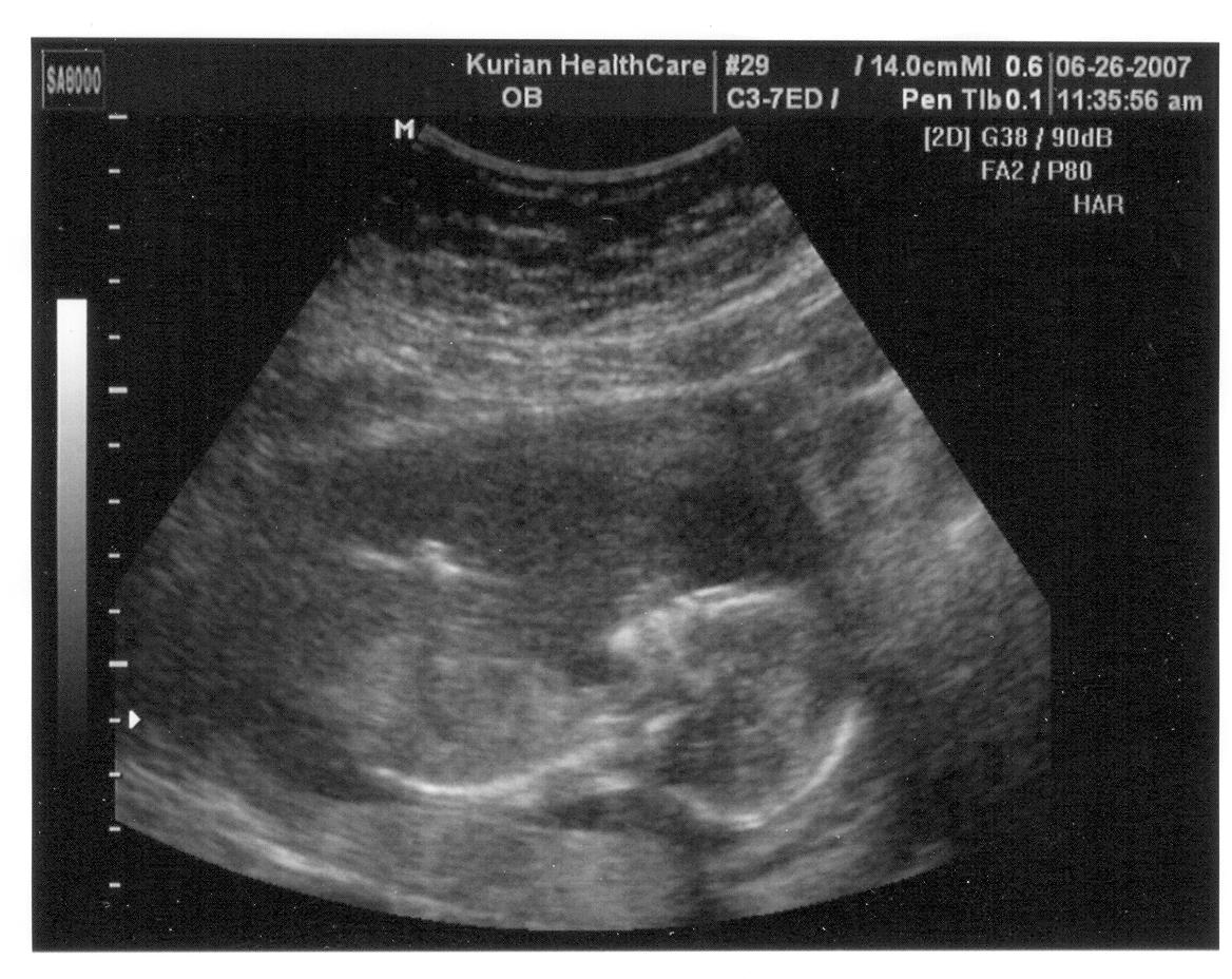 [16wk+ultrasound.jpg]