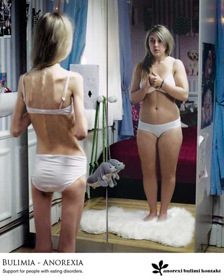 [anorexia-y-bulimia1.jpg]