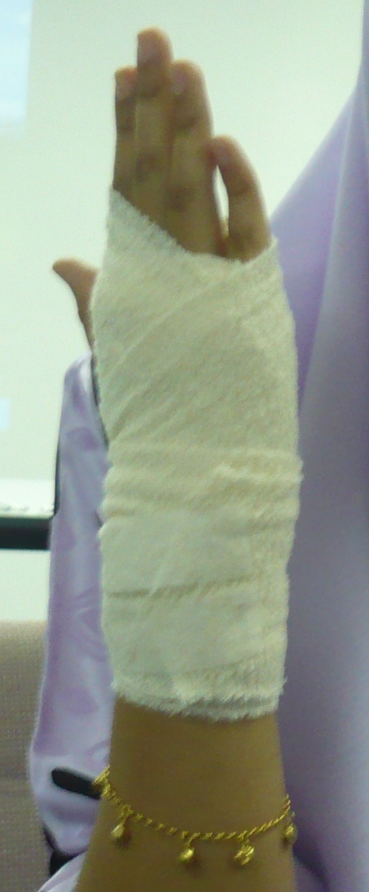 [bandageA.JPG]