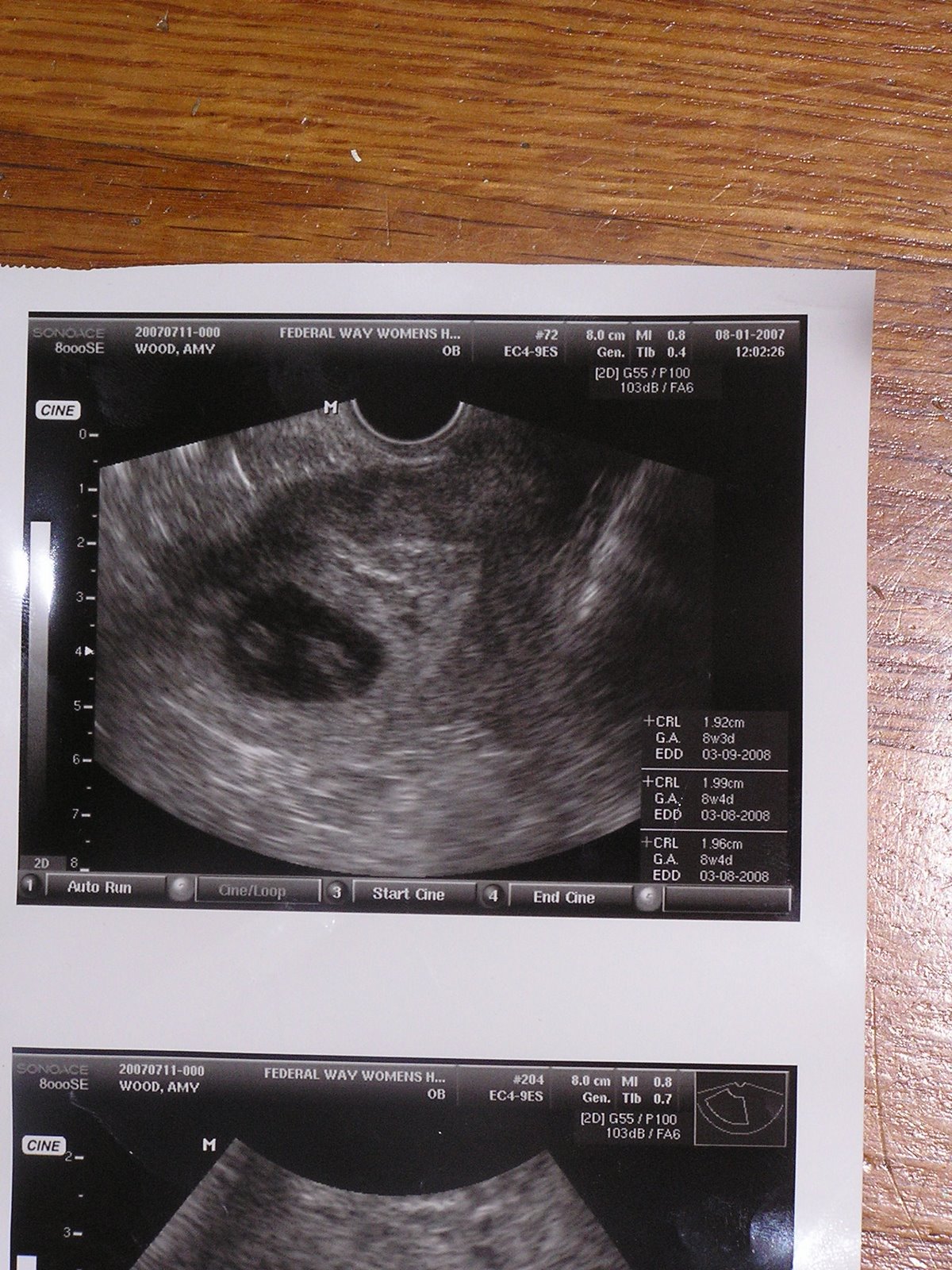 [1st+ultrasound.JPG]