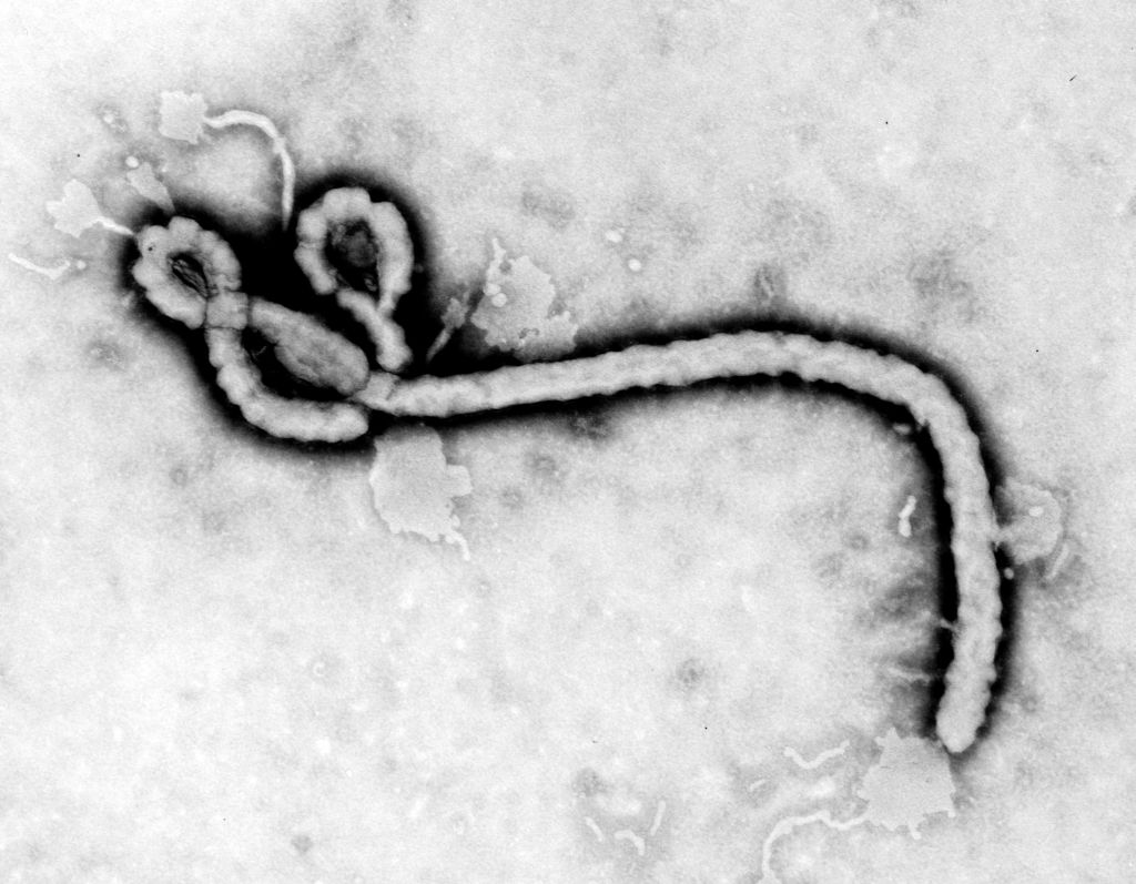 [ebola.jpg]