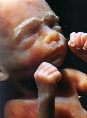 [fetus+23+weeks.jpg]