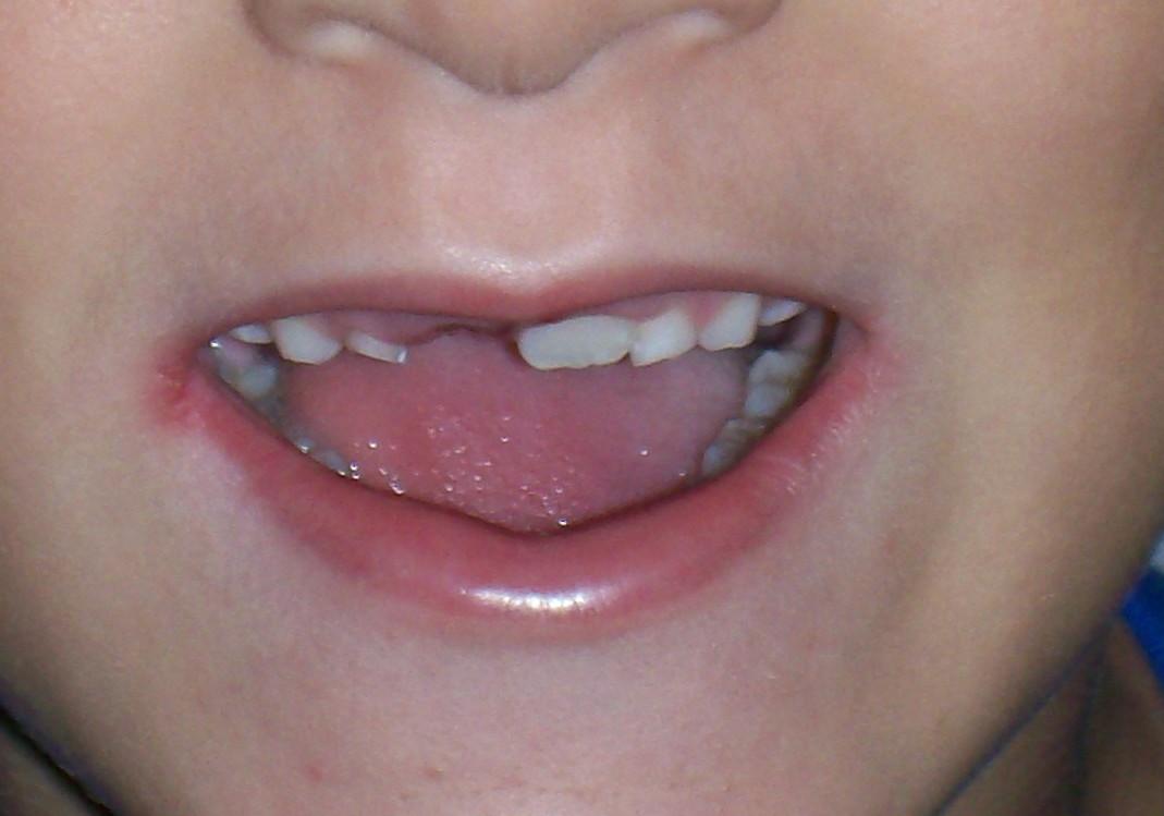 [Tooth+close+up.jpg]
