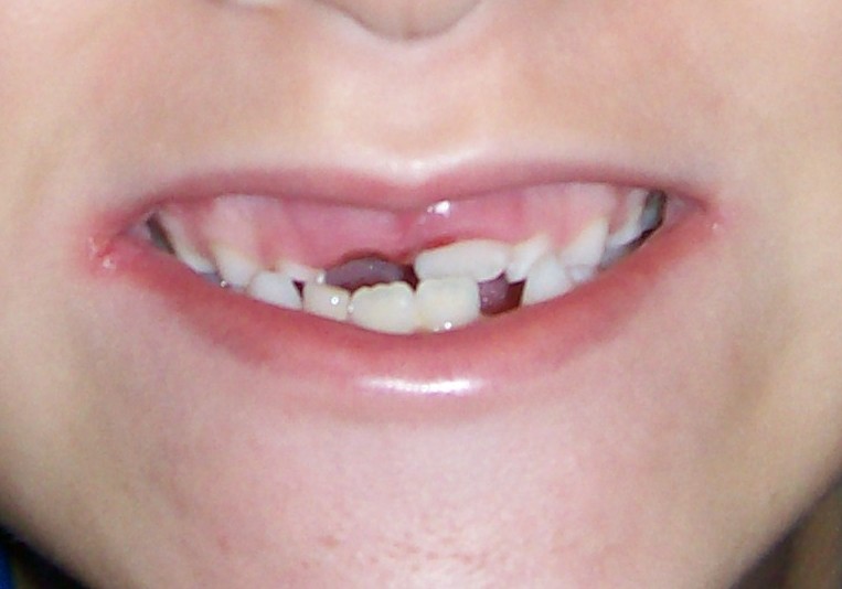 [Tooth+close+up+2.jpg]