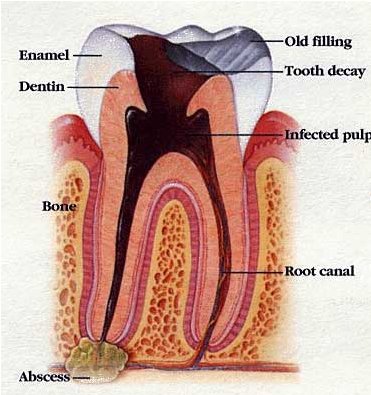[root+canal.jpg]